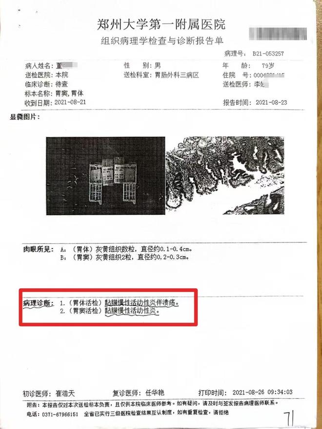 晚期切除全胃事发郑州详情曝出老汉患慢性胃炎医生竟按胃癌(图6)