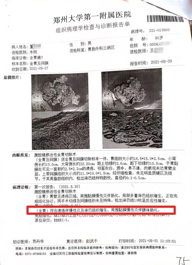 晚期切除全胃事发郑州详情曝出老汉患慢性胃炎医生竟按胃癌(图5)